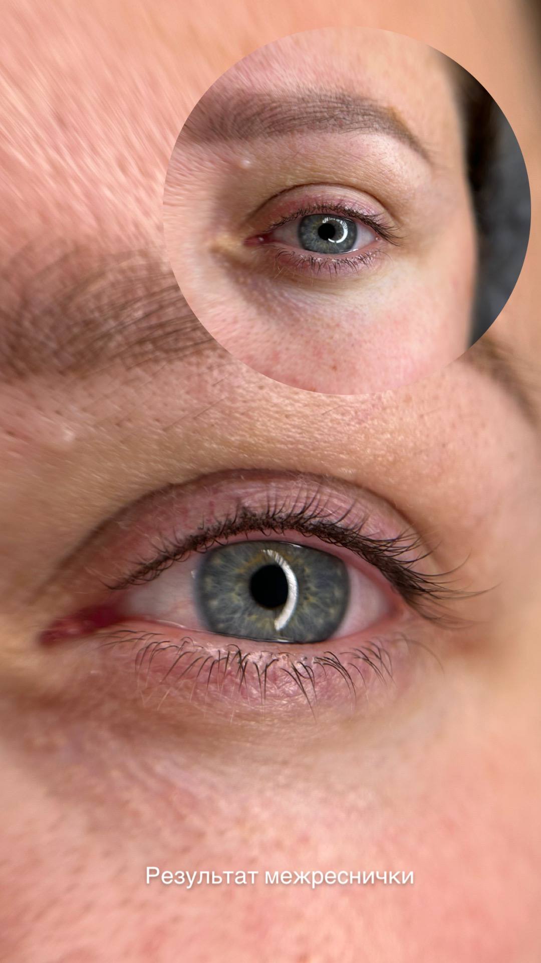 Депиляция шугаринг подмышек