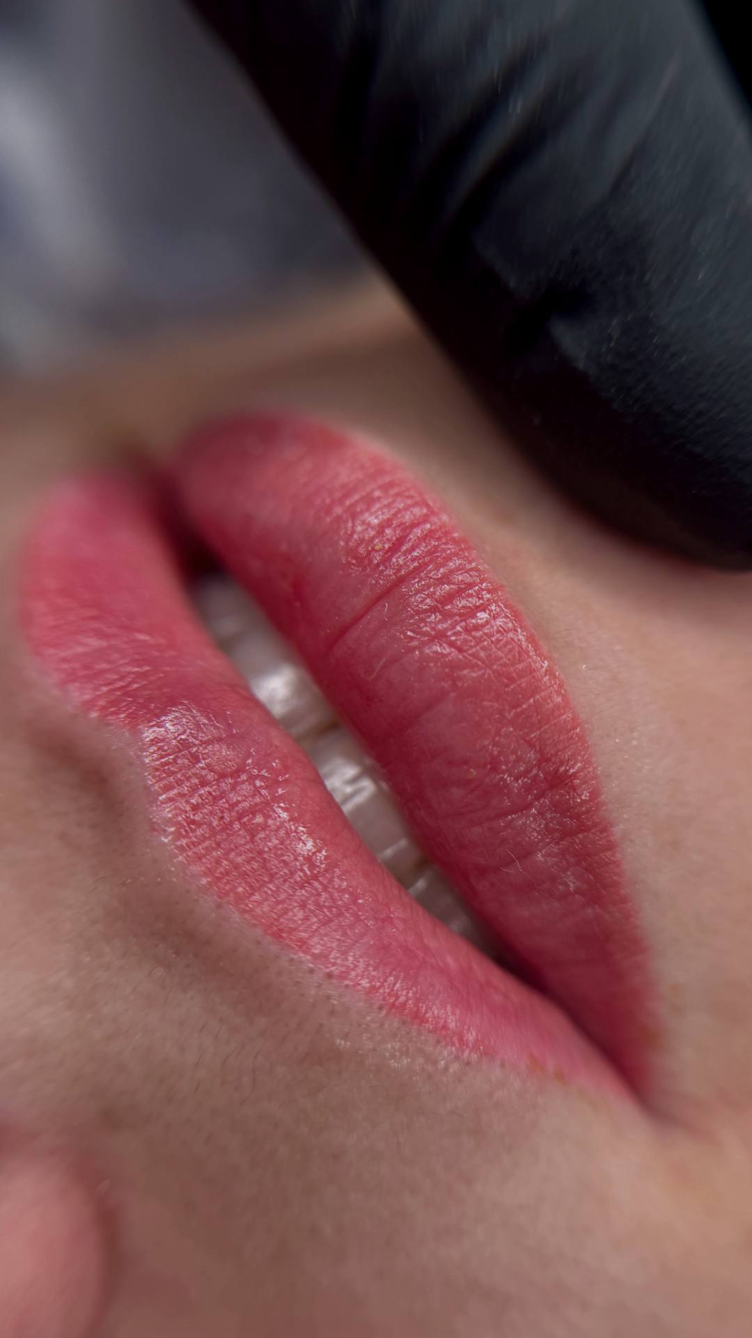 Депиляция шугаринг подмышек